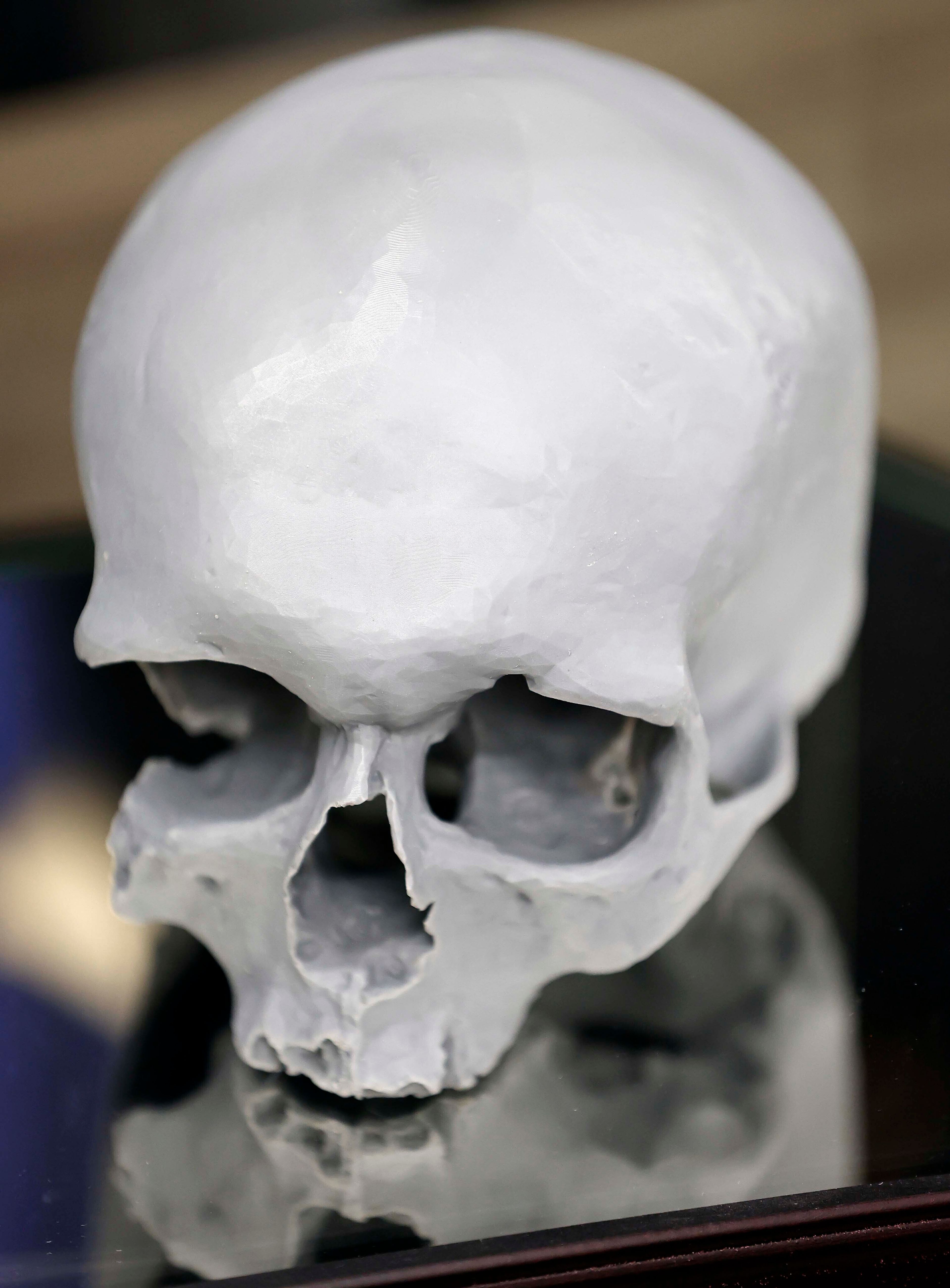 A 3D printed reproduction of a skull that was found in a wall of a house being remodeled in 1978 is seen during a press conference Thursday, Oct. 24, 2024 in St. Charles, Ill. Investigators have determined that a skull discovered in the wall of an Illinois home in 1978 was that of an Indiana teenager who died more than 150 years ago, authorities announced Thursday. (Brian Hill/Daily Herald via AP)